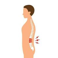 hombre con bajo espalda dolor síntoma en plano diseño en blanco antecedentes. vector