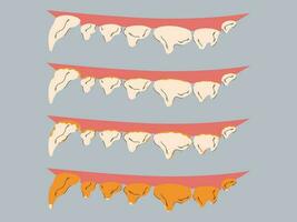 etapas de placa y sarro formación en perros. goma enfermedad prevención. perro dental cuidado concepto. vector ilustración