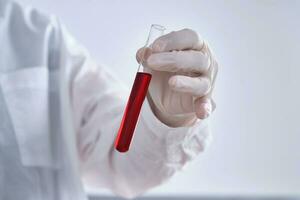 Test tube with blood in the hand. photo