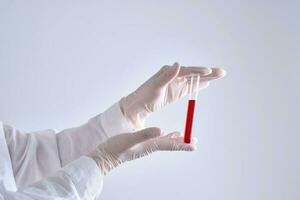 Test tube with blood in the hand. photo