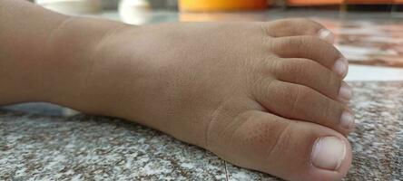 The shape of the feet of children under 5 years old. photo