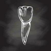 Highly detailed hand drawn human tooth  with roots. Hand drawn sketch. Illustration isolated on chalkboard  background. vector