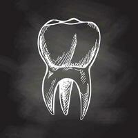 Highly detailed hand drawn human tooth  with roots. Hand drawn sketch. Molar illustration isolated on chalkboard background. vector