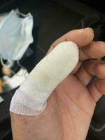 Left hand thumb get serious injury with thumb wound dressing in close up. photo