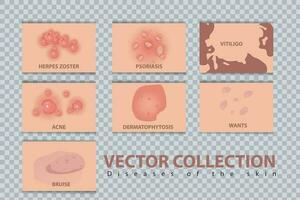 diferente tipos de psoriasis vector colocar. parte de pacientes piel con dermatitis, inflamación, rojo erupción y otro piel problemas vector ilustración adecuado para De las mujeres piel salud problemas