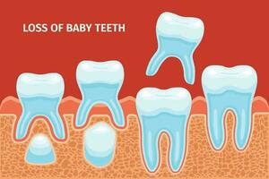 bebé dientes pérdida antecedentes vector