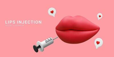 3d realista bandera para labio aumento procedimiento. labios inyección de hialurónico ácido. belleza clínica concepto. vector ilustración