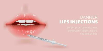 3D illustration of realistic lips undergoing a cosmetic procedure for aging care. Results of lip injections and wrinkle reduction, the correction and contouring of lips using fillers injection. vector