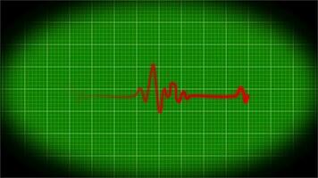 heart beat pulse line displaying in cardiograph monitor video