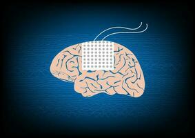 Illustration of subdural electrode over brain surface for EEG or brain waves monitoring in epilepsy surgery. vector