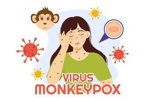 Monkey Pox Outbreak Vector Illustration of Virus Symptoms in Humans Monkeypox Microbiological in Flat Cartoon Hand Drawn Templates