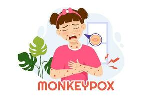 Monkey Pox Outbreak Vector Illustration of Virus Symptoms in Humans Monkeypox Microbiological in Flat Cartoon Hand Drawn Templates