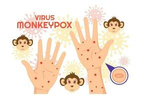 Monkey Pox Outbreak Vector Illustration of Virus Symptoms in Humans Monkeypox Microbiological in Flat Cartoon Hand Drawn Templates