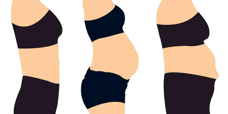 Womans Belly Tummy Tuck flabby skin Female Body Abdomen. Alcohol Hormonal  Stressed Mommy Apron Sagging protruding superficial tummy Demonstrating  Liposuction. Diet Weight Loss Fat Belly slim stomach 25940287 Vector Art at  Vecteezy