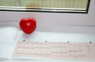 results cardiogram and rubber hand trainer in the shape of a heart photo