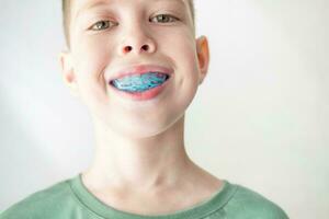 A teenager puts on a training mouthguard for the jaw, close-up. Correction of bite from childhood photo