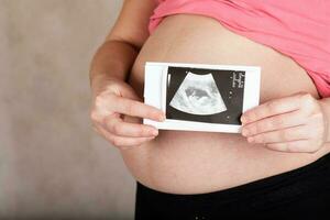 Young pregnant woman keeps USG image of her baby. photo