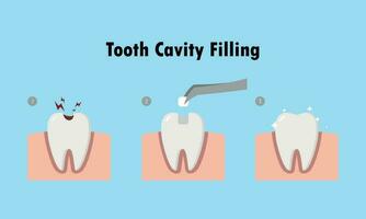 paso de restaurar cavidad diente por relleno diente ilustración dibujos animados personaje vector diseño en azul antecedentes. dental cuidado concepto.