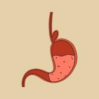 Hernia of the esophagus. Stomach problem. Vector illustration in flat style