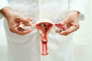 Uterus, doctor holding anatomy model for study diagnosis and treatment in hospital. photo