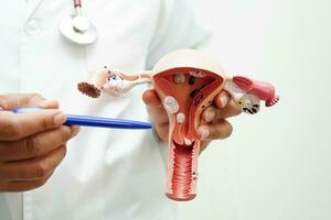 Uterus, doctor holding anatomy model for study diagnosis and treatment in hospital. photo