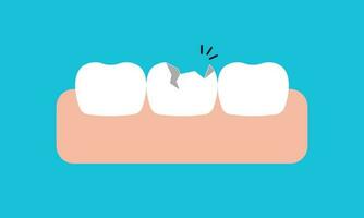 Broken white teeth and gums illustration vector design on blue background. Dental care concept.