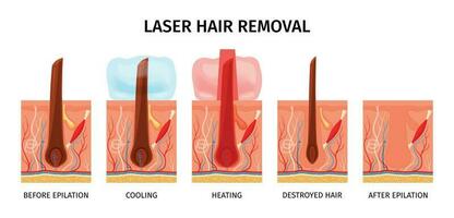 Laser Hair Removal Composition vector