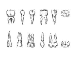 Stomatology hand drawn set. Toothache treatment. Teeth sketch. Different types of human tooth. Engraving fangs and molars. vector