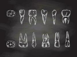 estomatología mano dibujado conjunto en pizarra antecedentes. dolor de muelas tratamiento. dientes bosquejo. diferente tipos de humano diente. grabado colmillos y molares vector