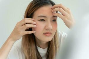 Young woman asian are worried about faces Dermatology and allergic to steroids in cosmetics. sensitive skin, red face from sunburn, acne, allergic to chemicals, rash on face. skin problems and beauty photo