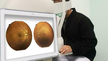 pacientes son examinando su vista con un fondo de ojo no midriático cámara en un poner en pantalla habitación para pacientes a riesgo de diabetes. foto