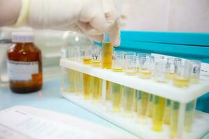 Test tubes with urine tests in a medical biochemical laboratory. photo