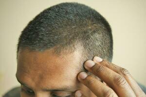 concepto de pérdida de cabello con el hombre revisando su cabello foto