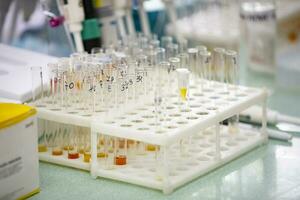 Many glass test tubes with analyzes in a medical laboratory. photo