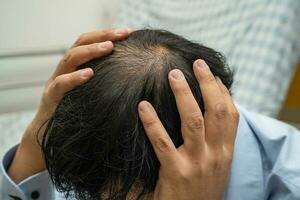 calvo en la cabeza media y sin pérdida de cabello glabro de hombre de oficina activo inteligente de negocios asiáticos maduros. foto