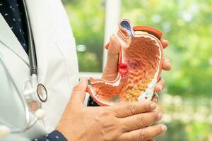 Stomach disease, doctor holding anatomy model for study diagnosis and treatment in hospital. photo