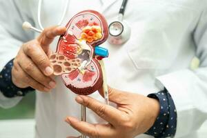 Kidney disease, Chronic kidney disease ckd, Doctor hold model to study and treat in hospital. photo