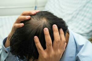 calvo en la cabeza media y sin pérdida de cabello glabro de hombre de oficina activo inteligente de negocios asiáticos maduros. foto