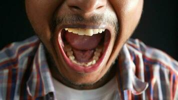 uma homem com dele boca aberto e dele dentes mostrando video