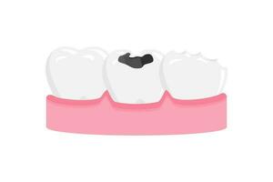 cavity teeth vector illustration. toothache icon sign symbol