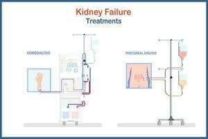 medical illustration Treatment of kidney failure. Hemodialysis and Peritoneal dialysis.Vector illustrations flat style.health care and medical concepts. vector