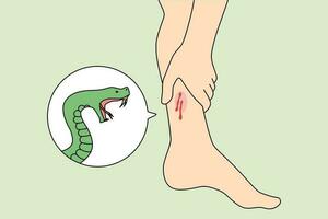 Close up of snake bite person leg need emergency medical help. Poisonous serpent snap outdoors. First aid and healthcare concept. Flat vector illustration.