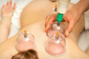 Acupuncture woman therapist placing the cup on the back of a female patient. photo