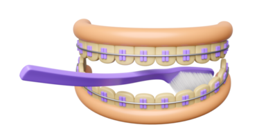 3d Kieferorthopädie Karikatur, Zähne Hosenträger mit Gummi, sauber Zahnbürste isoliert. 3d machen Illustration png