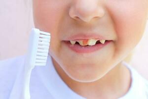 sangre en el dientes de un niño. foto