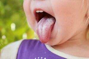 blanco revestimiento en lengua bebé. oral tordo. foto