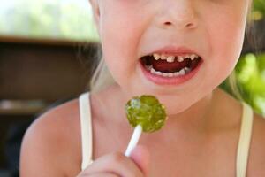 Child eats candy. Girl has caries on teeth. photo