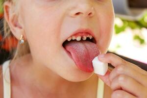 Child eats sugar. Girl has caries on teeth. photo