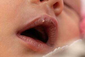 newborn baby with dry lips photo