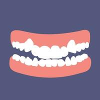 Orthodontic teeth problem crowding. Abnormal eruption. Double tooth. Opposite occlusion, open bite, crowded teeth, cavities, dentition. Vector illustration